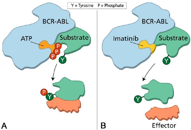 BCR-ABL과 이마티닙