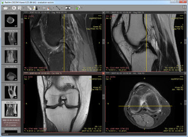 DICOM 뷰어를 통한 의료 영상 데이터 관리