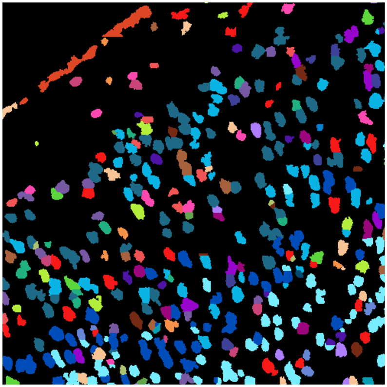 공간 세포 유형 식별